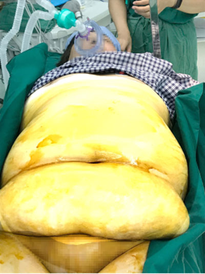 套牢_套牢盘是什么意思_套牢的股票如何解套